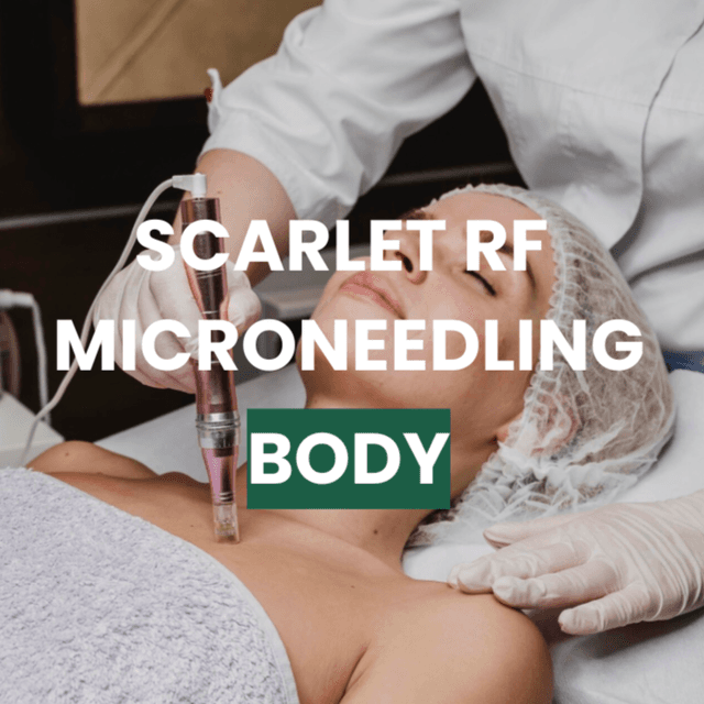 SRF Body - Multiple Areas x3 at Snap Medical Wellness in Libertyville, IL