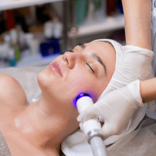 RF Tightening Facial x3 at Snap Medical Wellness in Libertyville, IL