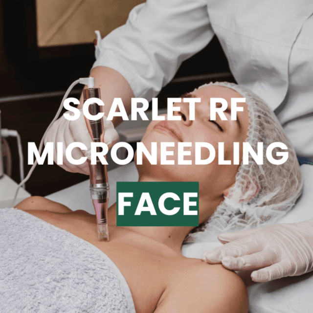 Full Face x3 at Snap Medical Wellness in Libertyville, IL