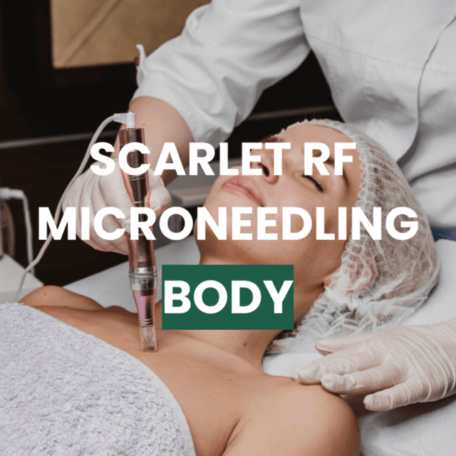 SRF Body - Single Area x3 at Snap Medical Wellness in Libertyville, IL